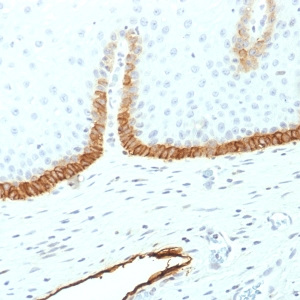 Podoplanin (PDPN) (Lymphatic Endothelial & Mesothelial Marker); Clone PDPN/1433 (Concentrate)